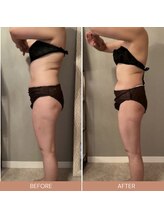 リファラ 光の森店(REFALA)/【痩身/30代女性】約3ヶ月の結果