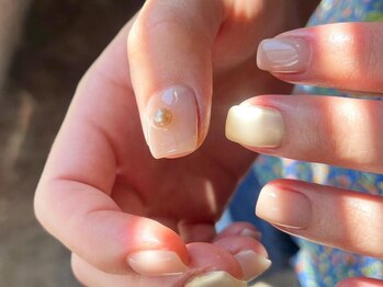 アイネイルズ 梅田店(I nails)/ちゅるんミラーマット¥9700