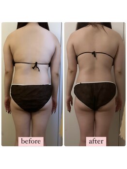 心奏(cocokana)/お客様施術1回での変化