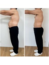 平川鍼灸接骨院 小堀院/腸内改善