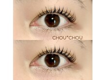 シュシュ(chou*chou)の雰囲気（施術イメージ）