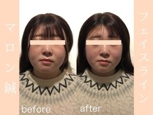 健志接骨院/BeforeAfter