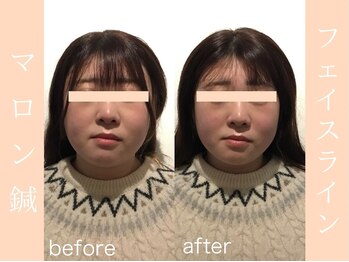 健志接骨院/BeforeAfter