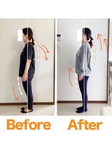 整体院ひなた 宮崎院/産後整体で肩こり腰痛骨盤-6cm!!