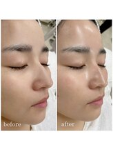 ラソ 県病院前店(lazo)/ララピール