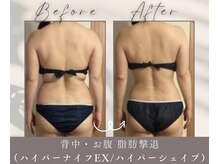 ドクタービラボ 錦糸町(Dr.Vilabo)の雰囲気（結果重視の本格ボディメイクです。痩身/下半身痩せ/二の腕）