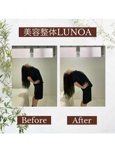 美容整体LUNOA　神戸三宮院/[三ノ宮/美容整体/整体/肩こり]