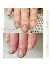 ケアビューティサロン(care beauty salon)/自爪育成ケア後