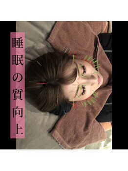 ルディア 堂島店(ledia)/大阪美容鍼は睡眠の質も向上