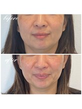 シーズボーテ(C's Beaute)/痛みが少ない施術で効果◎