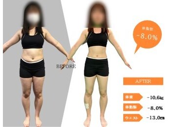 ジーサルース(Gサルース)/Y様（２０代）【４カ月】　前