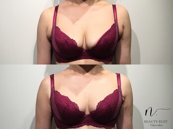 エヌドット 日本橋(N.)/ダイエット効果◎