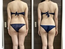 アール シュシュ(R.chouchou)/20代モデル様