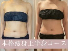 レイアス(Ray as)/ずっと痩せなかったお腹が◎