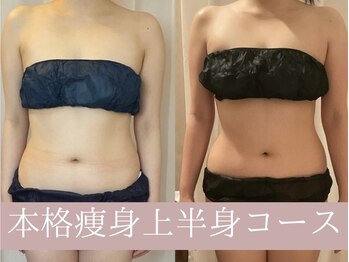 レイアス(Ray as)/ずっと痩せなかったお腹が◎