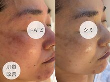 サロンパッテデシャット(salon patte de chat)の雰囲気（小顔/リフトアップ/ニキビケア/乾燥肌などの肌質改善/毛穴ケアも）