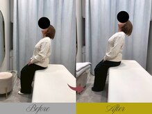 リン 大宮院(RIN)/Before/After