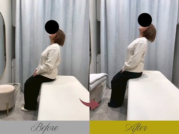 リン 大宮院(RIN)/Before/After