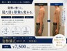 肩こり猫背ストレートネックの改善|男性用|姿勢矯正コース 60分¥7,500