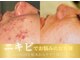 ル キヤ アイスペシャリテ ハービスENT店の写真