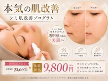 アンテイン(anthein)の雰囲気(最新肌管理マシーン!毛穴洗浄からプラズマ・IPL・サーマルまで)