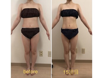 ココ(coco)/ダイエットモニター様