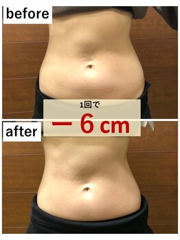 アンド ジョイ(&JOY)/お腹集中フルコース施術例☆