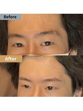 眉毛ハウス 吉祥寺店(眉毛HOUSE)/お客様の施術例(吉祥寺/東京)