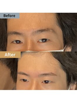 眉毛ハウス 吉祥寺店(眉毛HOUSE)/お客様の施術例(吉祥寺/東京)