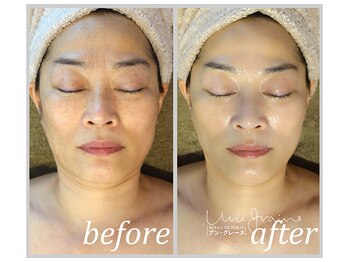 アン グレーヌ 自由が丘(unegraine)/シャープに引き締まる！