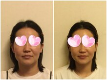 シエル(CIEL)/あごがスッキリキレイに！