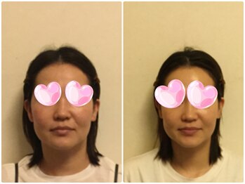 シエル(CIEL)/あごがスッキリキレイに！