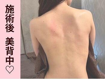 クイーンズチャーム(Queen's Charm)/パワーツリー★背中、ブライダル