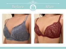 美人バスト 千早店/バストアップ◇育乳症例◇