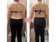 ラフィール/ブライダルエステ：背中引き締め