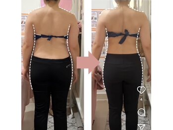 ラフィール/ブライダルエステ：背中引き締め