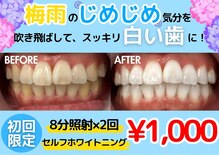 LBSホワイトニング 上野店