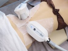 エステティックサロン フェアリー(ESTHETIC SALON FAIRLY)/【痩身】ハイスペック脂肪冷却