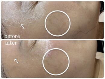 ビノスビューティー(vinos.beauty)/ReLABEAUTEハーブトリートメント