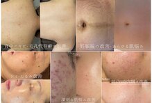 プラウディア(PROUDIA)