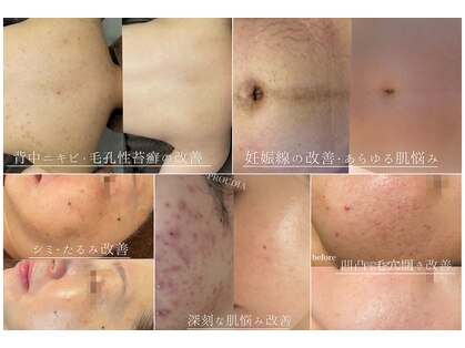 プラウディア(PROUDIA)の写真