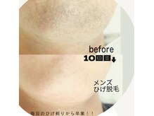 ルアナ(luana)の雰囲気（完全都度払い制　毎日のひげ剃りから卒業できます！）