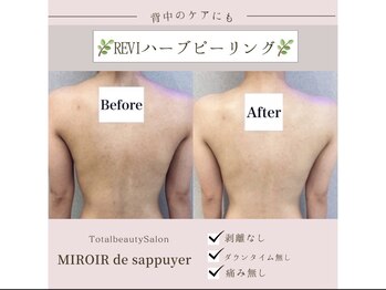 ミロワール ドゥ サピュイェ(MIROIR de Sappuyer)/★お背中ハーブも人気★
