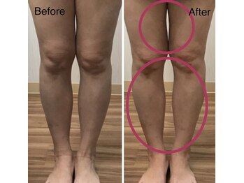 エクルビューティーツー(ECRU Beauty 2)/フォースカッター　美脚