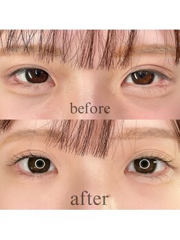 フォーヴリュンヌ(FOVLUNE)/ラッシュリフト