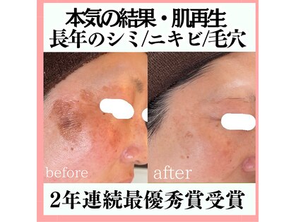 リアリア(LEALEA)の写真
