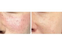 ソナ 大和西大寺院(SONA)/