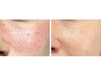 ソナ 大和西大寺院(SONA)/