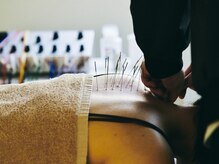 鍼処シラカワ なごや院千種(鍼処SHIRAKAWA)/