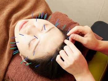 三国はら鍼灸整骨院の写真/《美容鍼デコルテリンパマッサージ》むくみ/くすみ/たるみ改善！深層筋肉を刺激し小顔をキープ★